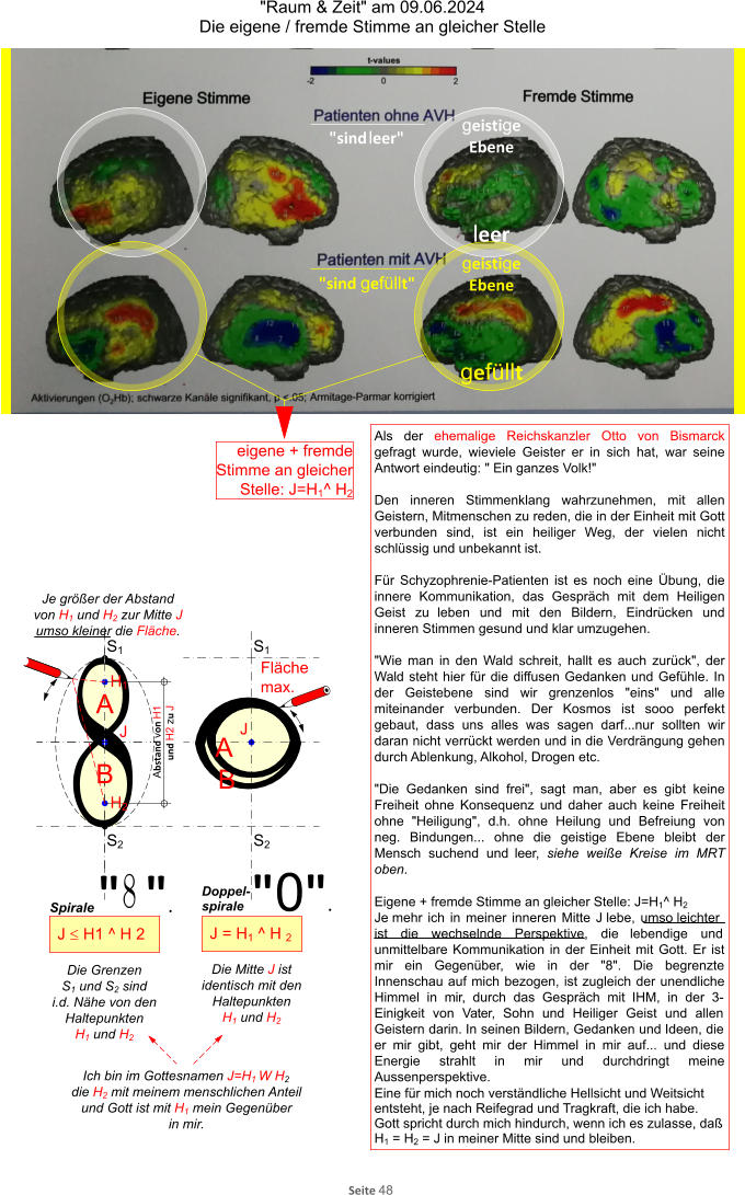 "Raum & Zeit" am 09.06.2024 Die eigene / fremde Stimme an gleicher Stelle Seite 48 •• Als der ehemalige Reichskanzler Otto von Bismarck gefragt wurde, wieviele Geister er in sich hat, war seine Antwort eindeutig: " Ein ganzes Volk!"  Den inneren Stimmenklang wahrzunehmen, mit allen Geistern, Mitmenschen zu reden, die in der Einheit mit Gott verbunden sind, ist ein heiliger Weg, der vielen nicht schlüssig und unbekannt ist.  Für Schyzophrenie-Patienten ist es noch eine Übung, die innere Kommunikation, das Gespräch mit dem Heiligen Geist zu leben und mit den Bildern, Eindrücken und inneren Stimmen gesund und klar umzugehen.  "Wie man in den Wald schreit, hallt es auch zurück", der Wald steht hier für die diffusen Gedanken und Gefühle. In der Geistebene sind wir grenzenlos "eins" und alle miteinander verbunden. Der Kosmos ist sooo perfekt gebaut, dass uns alles was sagen darf...nur sollten wir daran nicht verrückt werden und in die Verdrängung gehen durch Ablenkung, Alkohol, Drogen etc.  "Die Gedanken sind frei", sagt man, aber es gibt keine Freiheit ohne Konsequenz und daher auch keine Freiheit ohne "Heiligung", d.h. ohne Heilung und Befreiung von neg. Bindungen... ohne die geistige Ebene bleibt der Mensch suchend und leer, siehe weiße Kreise im MRT oben.  Eigene + fremde Stimme an gleicher Stelle: J=H1^ H2 Je mehr ich in meiner inneren Mitte J lebe, umso leichter ist die wechselnde Perspektive, die lebendige und unmittelbare Kommunikation in der Einheit mit Gott. Er ist mir ein Gegenüber, wie in der "8". Die begrenzte Innenschau auf mich bezogen, ist zugleich der unendliche Himmel in mir, durch das Gespräch mit IHM, in der 3-Einigkeit von Vater, Sohn und Heiliger Geist und allen Geistern darin. In seinen Bildern, Gedanken und Ideen, die er mir gibt, geht mir der Himmel in mir auf... und diese Energie strahlt in mir und durchdringt meine Aussenperspektive. Eine für mich noch verständliche Hellsicht und Weitsicht entsteht, je nach Reifegrad und Tragkraft, die ich habe. Gott spricht durch mich hindurch, wenn ich es zulasse, daß H1 = H2 = J in meiner Mitte sind und bleiben. eigene + fremde Stimme an gleicher Stelle: J=H1^ H2 geistige Ebene leer geistige Ebene gefüllt S1 S2 H1 H2 A B J J = H1 ^ H 2 J £ H1 ^ H 2 S1 S2 J B Abstand von H1 und H2 zu J Die Mitte J ist identisch mit den Haltepunkten H1 und H2 Die Grenzen S1 und S2 sind i.d. Nähe von den Haltepunkten H1 und H2 Fläche max. Je größer der Abstand von H1 und H2 zur Mitte J umso kleiner die Fläche. Ich bin im Gottesnamen J=H1 W H2 die H2 mit meinem menschlichen Anteil und Gott ist mit H1 mein Gegenüber in mir. "0". Spirale "  ". Doppel-spirale "sind leer" "sind gefüllt" A